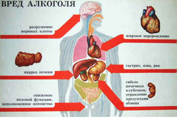 Медики Стародубской ЦРБ разъясняют, чем вреден алкоголь для организма мужчин, женщин и подростков